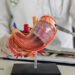 The Hidden Costs of Bariatric Surgery