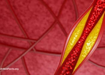 How Low Can LDL Cholesterol Go on PCSK9 Inhibitors?