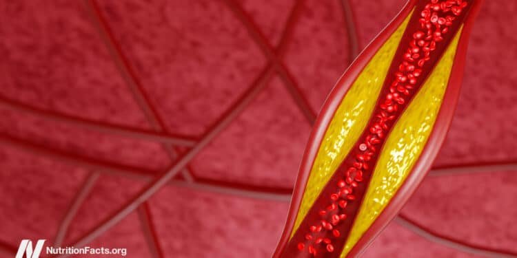 How Low Can LDL Cholesterol Go on PCSK9 Inhibitors?