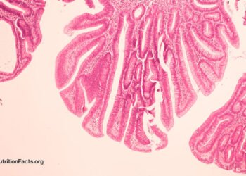 Could Bovine Leukemia Virus be a Cause of Breast Cancer?