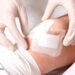 From Gastric Balloons to Fake Knee Surgeries: When the Fix Is an Illusion