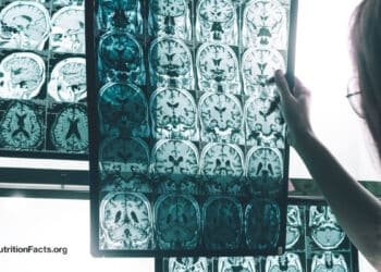 A Persistent Pesticide Is Linked to Alzheimer’s Risk