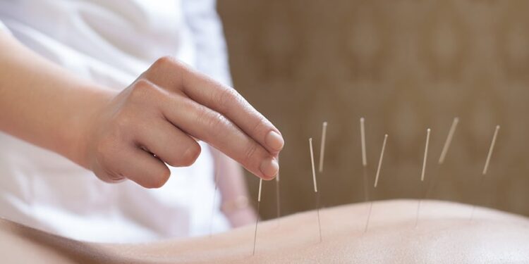 Needles, Knots and Nudges: A Guide to Alternative Therapies for Pain and Injury